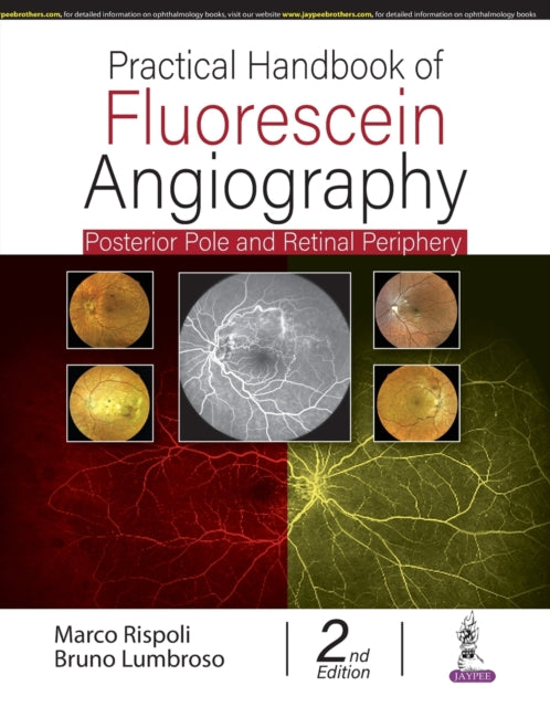 Book cover of: Practical Handbook of Fluorescein Angiography. By: Marco Rispoli