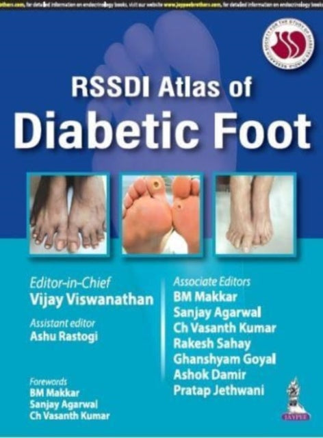 Book cover of: RSSDI Atlas of Diabetic Foot. By: Vijay Viswanathan