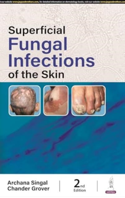 Book cover of: Superficial Fungal Infections of the Skin. By: Archana Singhal