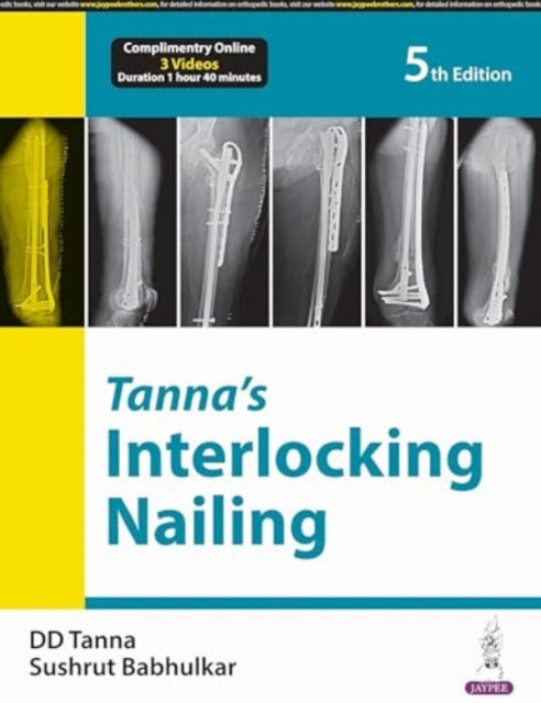 Book cover of: Tanna’s Interlocking Nailing. By: Sushrut Babhulkar