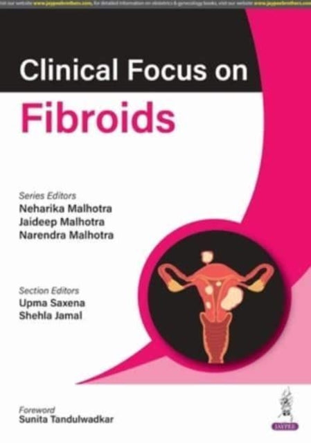 Book cover of: Clinical Focus on Fibroids