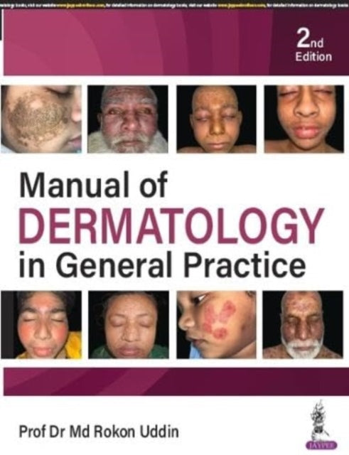 Book cover of: Manual of Dermatology in General Practice. By: Rokon Uddin