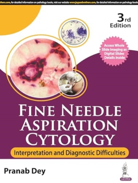 Book cover of: Fine Needle Aspiration Cytology. By: Pranab Dey