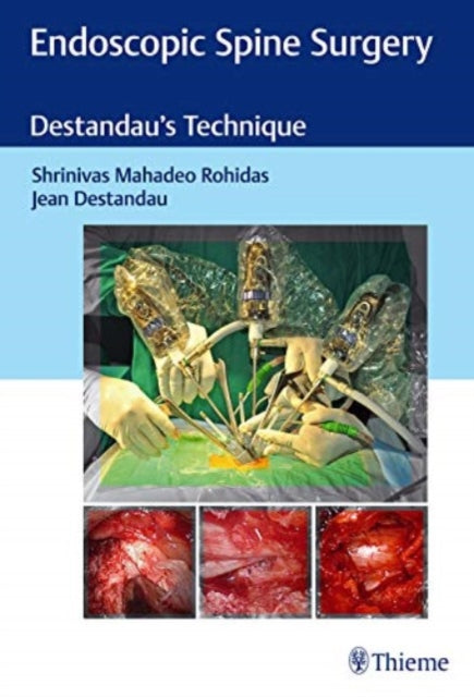 Book cover of: Endoscopic Spine Surgery