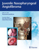 Book cover of: Juvenile Nasopharyngeal Angiofibroma. By: Narayanan Janakiram