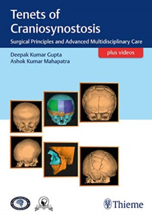 Tenets of Craniosynostosis