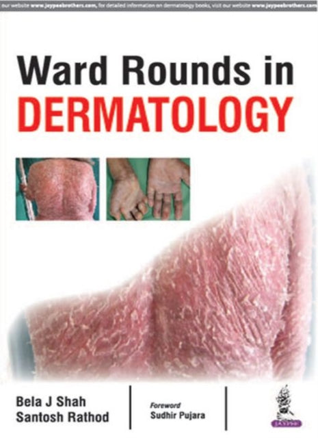Book cover of: Ward Rounds in Dermatology. By: Santosh Rathod