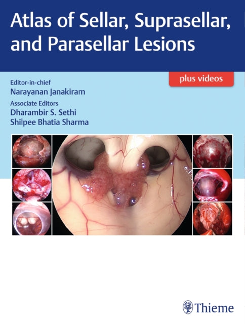 Book cover of: Atlas of Sellar, Suprasellar, and Parasellar Lesions. By: Narayanan Janakiram