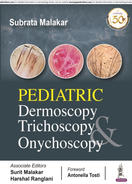Book cover of: Pediatric Dermoscopy Trichoscopy & Onychoscopy. By: Subrata Malakar