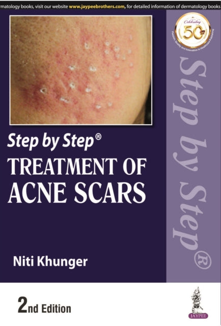 Book cover of: Step by Step Treatment of Acne Scars. By: Niti Khunger