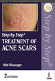 Book cover of: Step by Step Treatment of Acne Scars. By: Niti Khunger