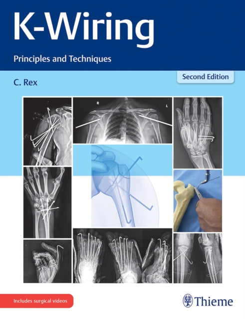 Book cover of: K-Wiring. By: Rex Chandrabose