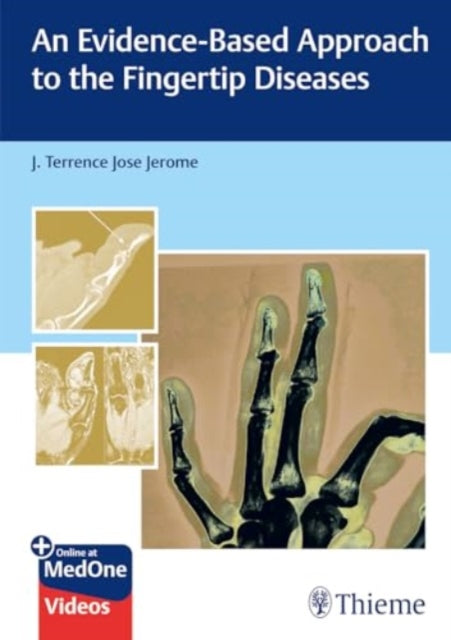 Book cover of: Evidence-Based Approach to the Fingertip Diseases. By: J. Terrence Jerome