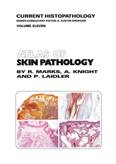 Book cover of: Atlas of Skin Pathology. By: R.M. Marks
