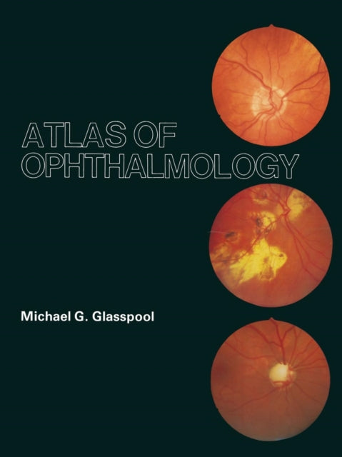 Book cover of: Atlas of Ophthalmology. By: M. G. Glasspool