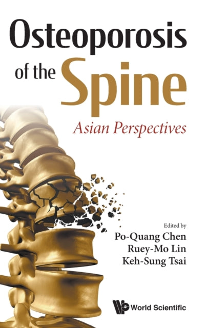 Book cover of: Osteoporosis Of The Spine: Asian Perspectives. By: AL