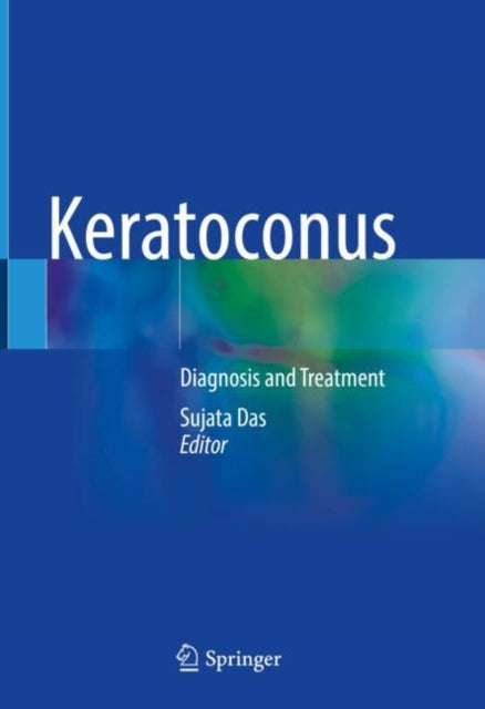 Book cover of: Keratoconus. By: Sujata Das