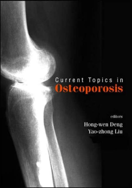 Book cover of: Current Topics In Osteoporosis