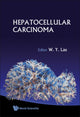 Book cover of: Hepatocellular Carcinoma