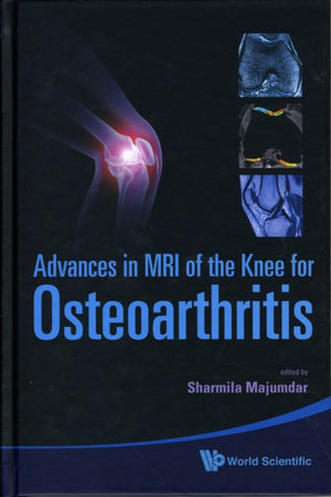 Advances In Mri Of The Knee For Osteoarthritis