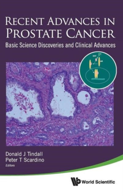 Book cover of: Recent Advances In Prostate Cancer: Basic Science Discoveries And Clinical Advances. By: Donald Tindall