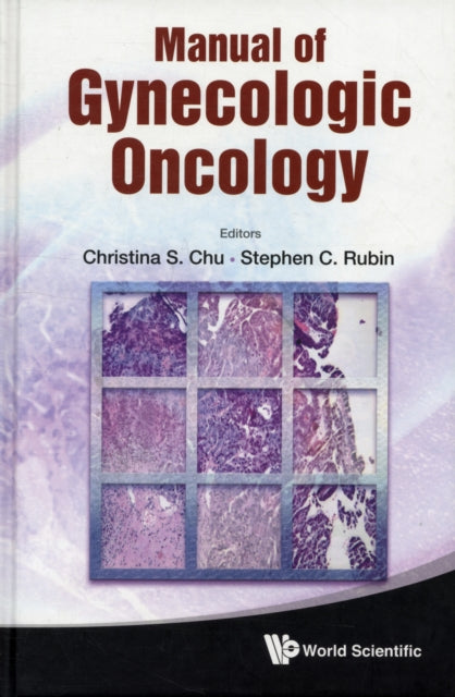 Book cover of: Manual Of Gynecologic Oncology. By: Christina S. Chu
